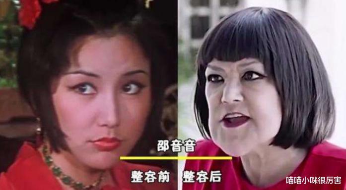 邵音音|年轻时惊为天人,整容后却颜值崩塌,这3位女明星,容貌变化大