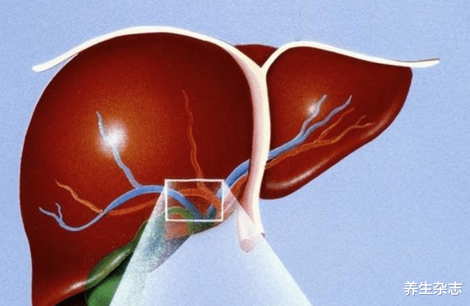 肝癌|34岁女子体重骤降,查出肝癌,医生:这种汤天天喝,铁打的肝也受不住