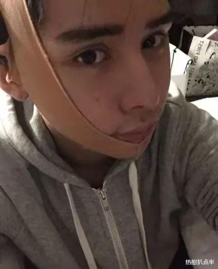 整容|整容脸充斥电视剧，脸部僵硬，下巴像锥子，个个不能细看?