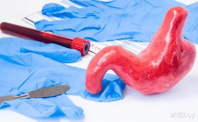 胆固醇|胃部平衡被“打破”的3个表现，提醒：2类食物常吃，救胃于“水火”