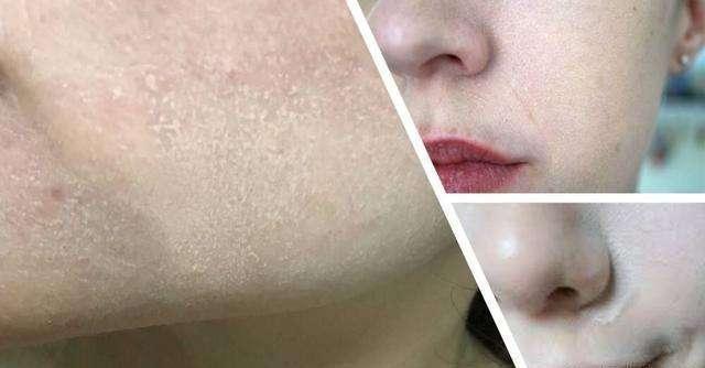 |女星们特写镜头下的“尴尬”，有点瑕疵没什么，卡粉浮粉一言难尽