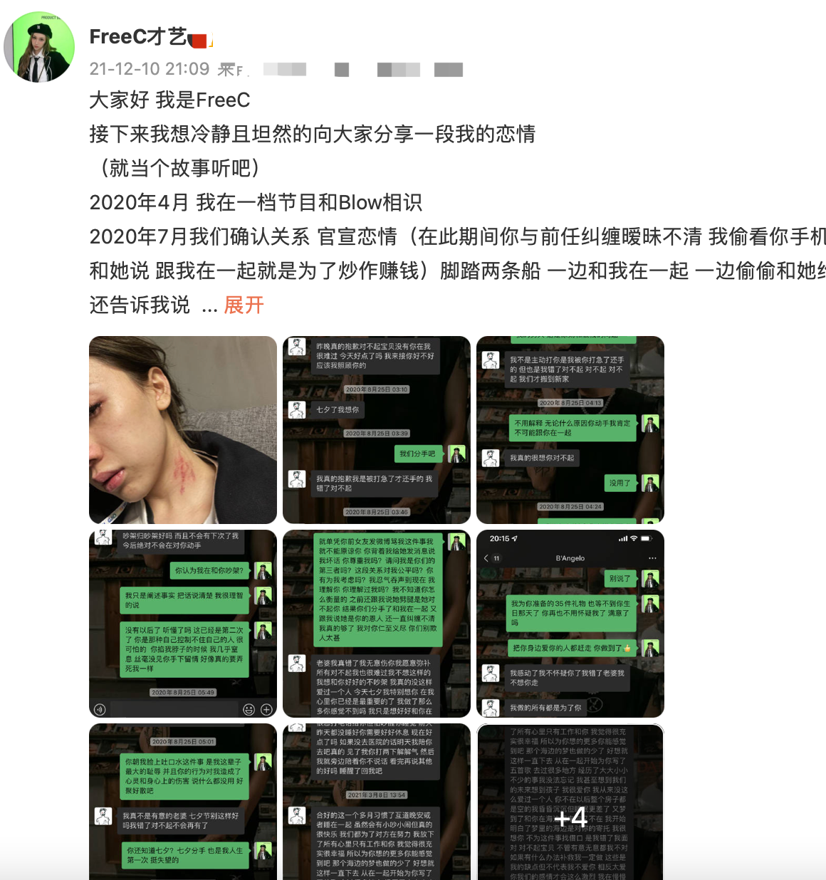 FreeC|歌手FreeC曝前任家暴！脸上被吐口水耳膜穿孔，染病后独自做手术