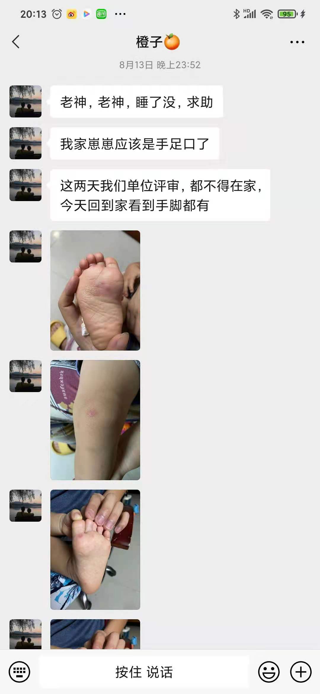 老神中医|不到2岁的宝宝突发手足口，妈妈求助中医，一天就不发烧了