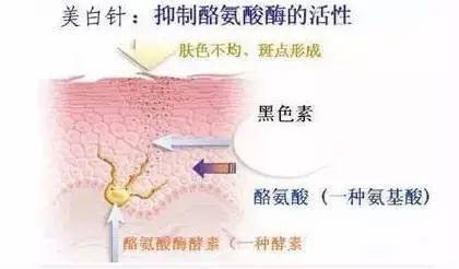 黑色素|6年前打美白针成“白灯泡”的女人，现在啥样，网友：还好没跟风