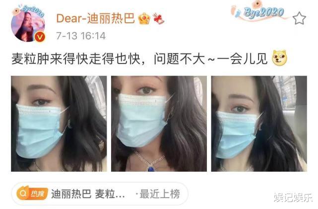 迪丽热巴|热巴长麦粒肿，把头发剪短遮挡面部，后又戴上墨镜效果意外的好