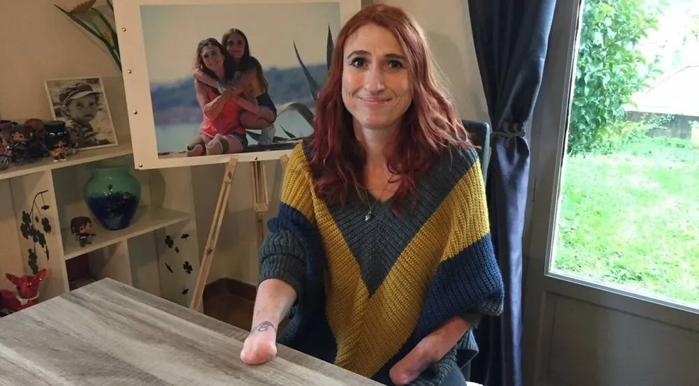 失眠|一次简单体检却导致四肢被截,南法一名女士命运令人唏嘘