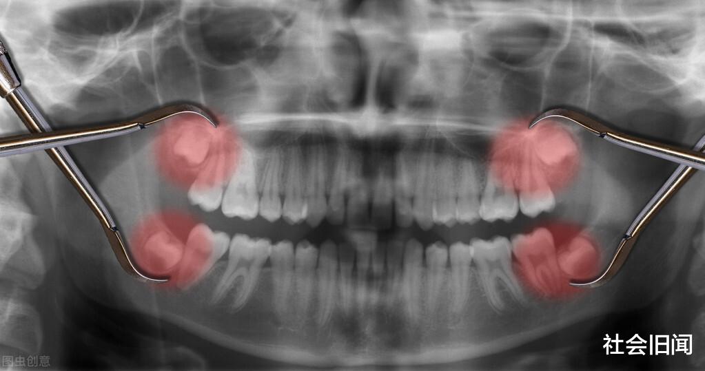  人类进化到最后并不完美，身上至少有五处重大缺陷，如果去除将超神