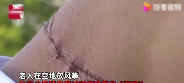 小影笔记 云南一老人空地放风筝，外卖小哥路过遭割喉，网友：孩子都会认错