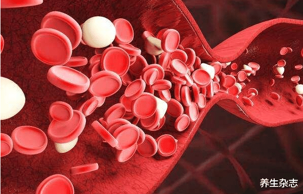 养生杂志|吃一次胜过8斤苦瓜,心内科专家提醒:高血脂的人不妨放开吃,远离血栓预防脑梗