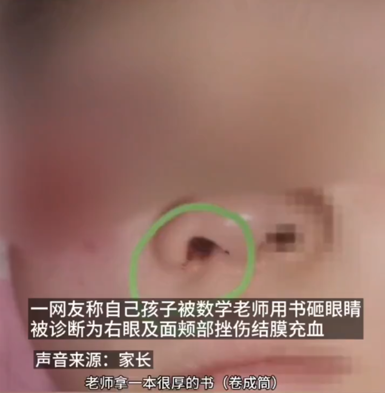 前沿大观察 师德？小学生遭数学老师殴打，家长：孩子现在经常半夜哭醒