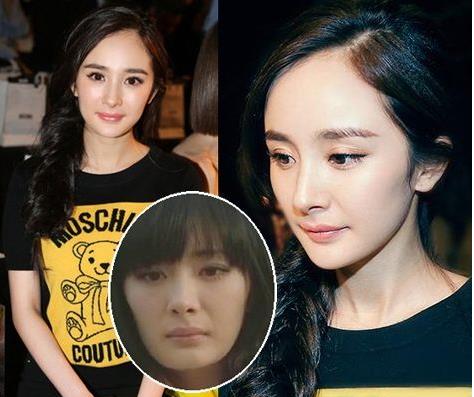 后遗症|7位“动过刀”的女星，梦想成女神，结果变女鬼，个个后遗症一堆