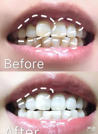 严选|被称为“国宝级”的牙膏，却因低价无人问津，景甜：用了半管黄渍就没了