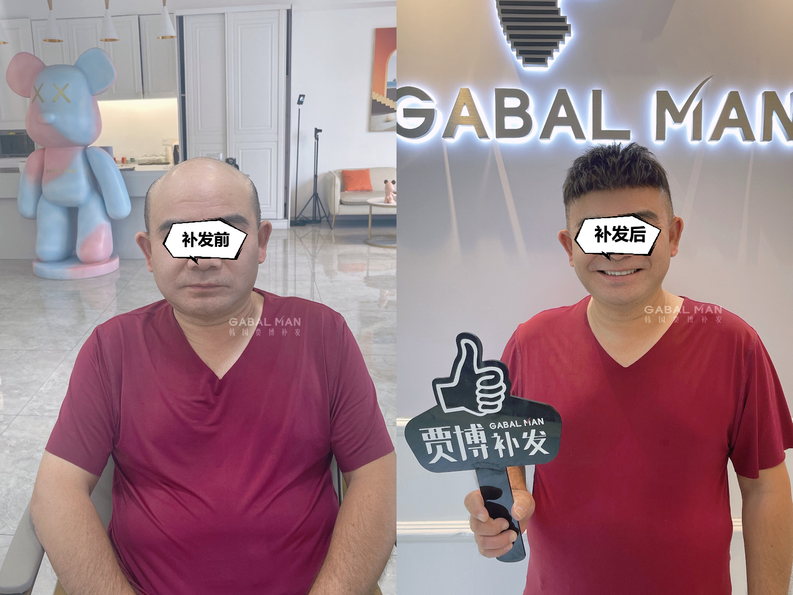 GabalMan贾博补发|超70岁还能补发吗？安全无副作用，轻松比同龄人年轻10岁