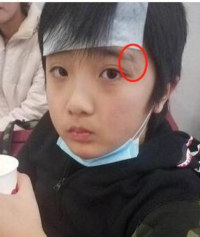 吴镇宇|吴镇宇儿子费曼近照：眼角疤痕仍触目惊心，难怪当时气得怒摔话筒