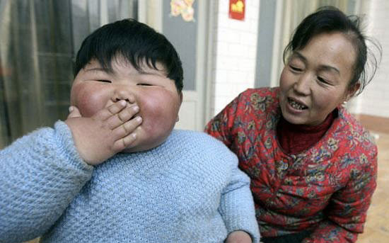 拔火罐|29岁超级网红猝然离世,死因引发热议:原来,一切本可以避免