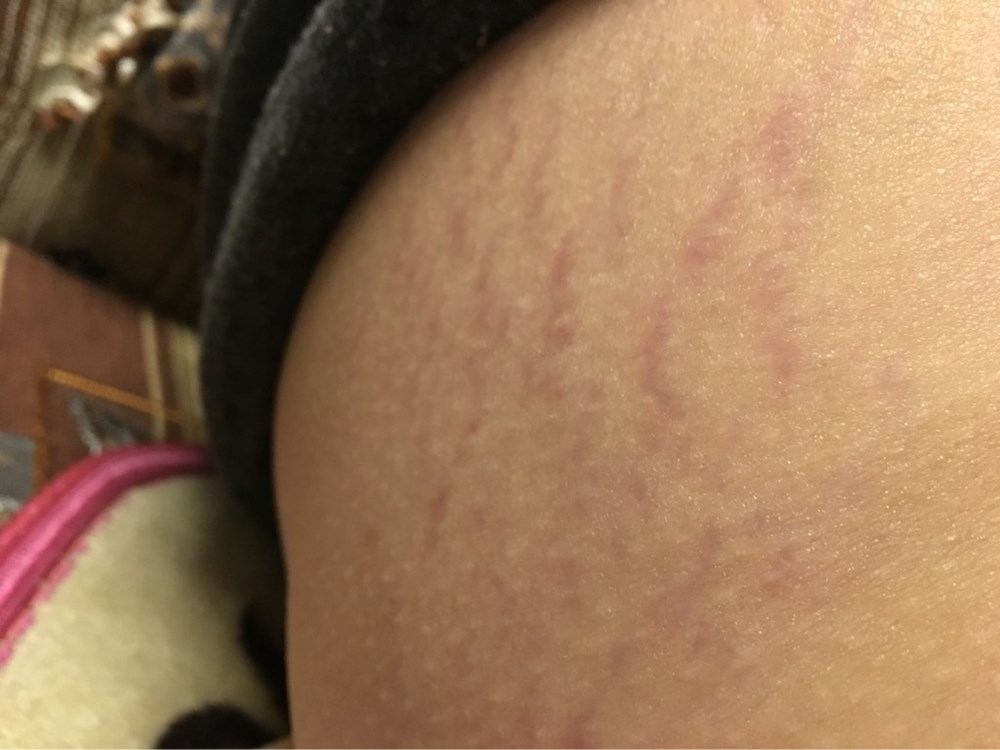 宝宝树|女性“打过胎”和“没打过胎”,医生一眼就能看穿!