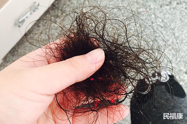 脱发|秋冬之际总是脱发、头屑增多，怎么办？用盐和醋洗头就能缓解？