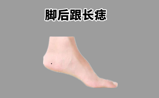 中国易经风水|身上4颗“苦”痣，打一辈子工，三餐吃不饱，脚下无房，没后福！