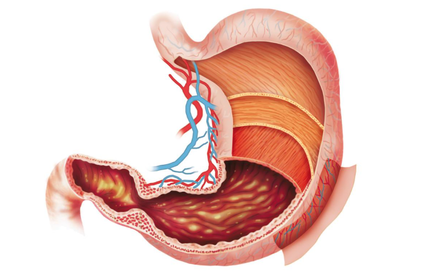 牛奶|胃粘膜“修复器”已公布，热牛奶未上榜，医生：常吃1物，烂胃慢慢恢复