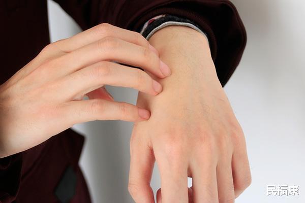 山楂|为什么一到冬季手、脚、唇容易起皮干裂？缓解的方法，可要学会了