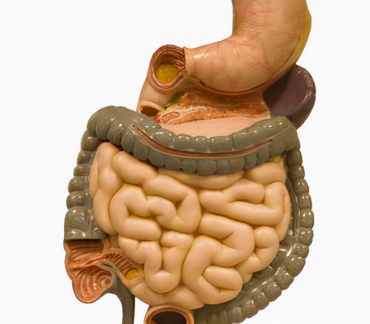 饮食|3天没排便，30岁小伙确诊肠癌？医生：预防靠饮食，选择很重要