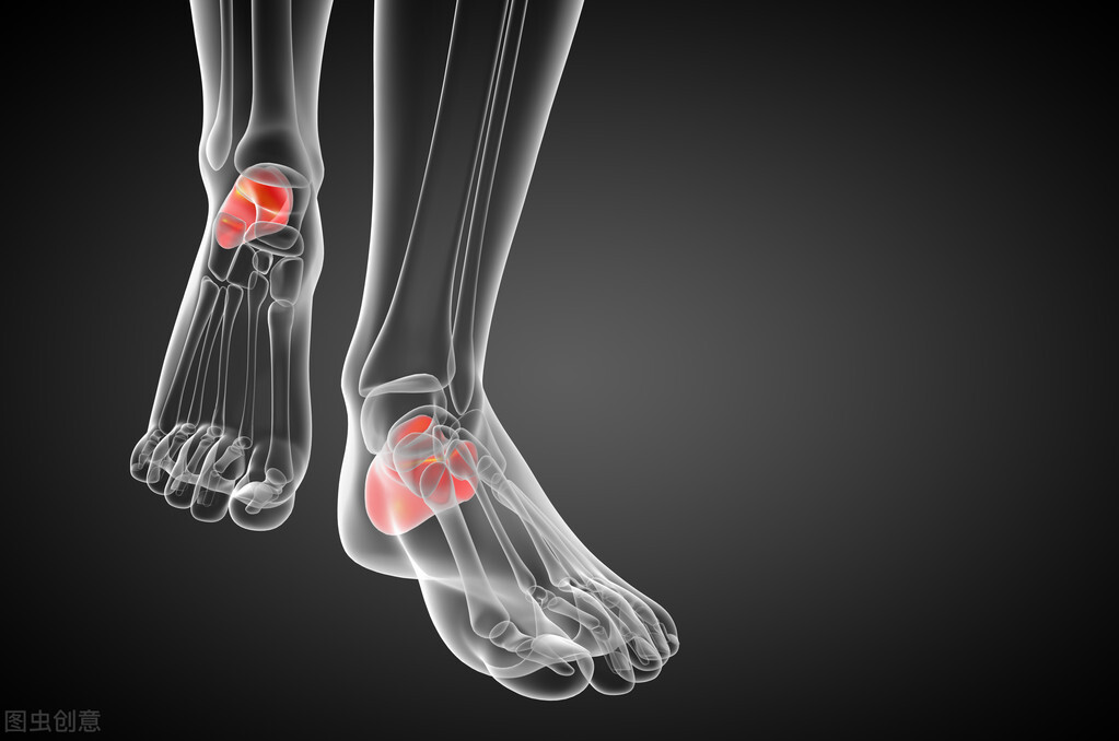 痛风|痛风和高尿酸药物有哪些？他们的区别和注意事项是什么？