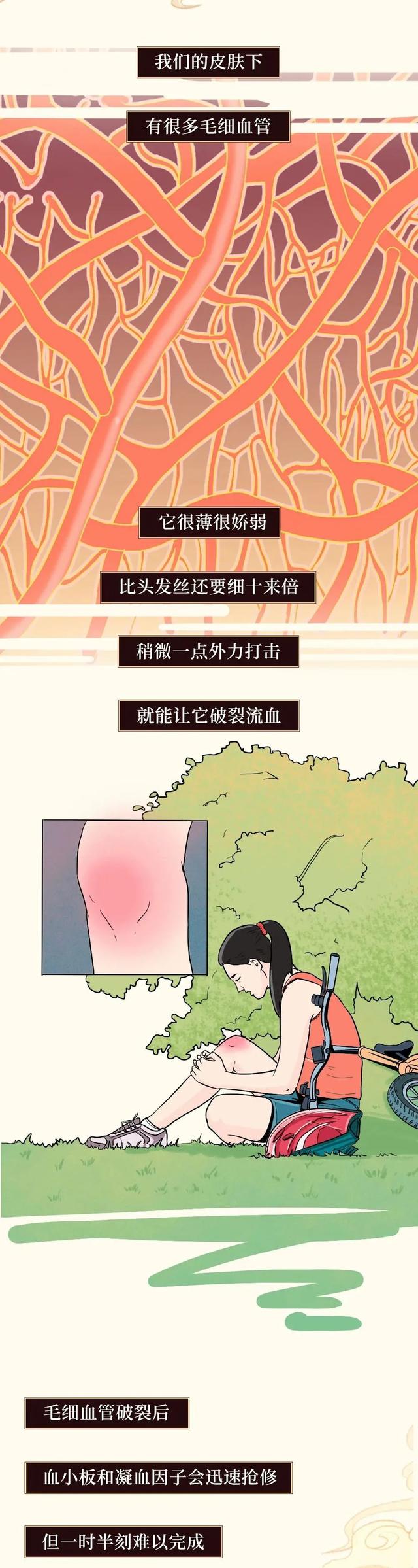 90后宝妈经验|女生膝盖上的淤青到底是怎么来的？从科学的角度告诉你真实原因