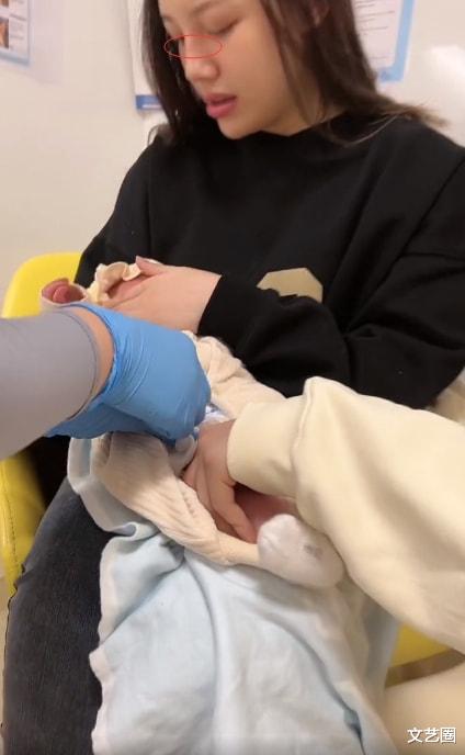 整容|兜儿产后素颜出镜，鼻子上有疤被质疑整容，否认称：之前摔跤缝针