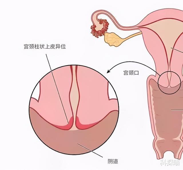 尿常规|提醒广大女性：一般情况下，3种“妇科病”不用治，别太担忧