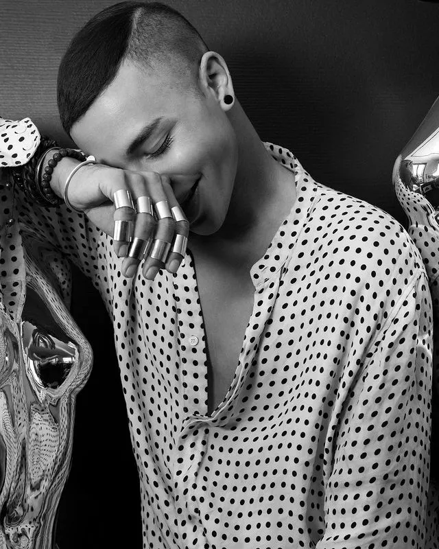 InsDaily 他被嘲“整形怪”10年！如今自曝毁容烧伤照，网友：又来炒作！