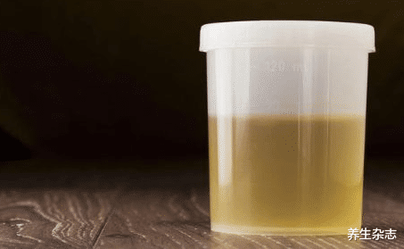 肝癌|新婚夫妻双双确诊肝癌，抱头痛哭，医生叹息：天天洗碗，为何不清洗它？