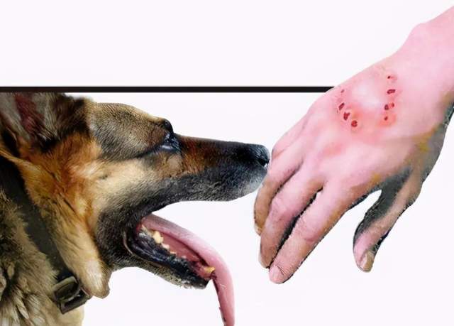 致死率100%的狂犬病,究竟有多可怕?