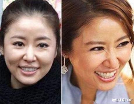 王一博|女星们“没有滤镜”长啥样？看到她们的未修生图，网友们不淡定了