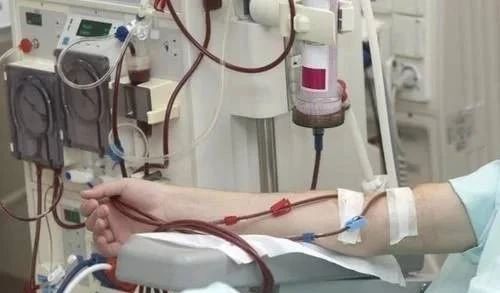 尿酸|尿毒症多是“吃”出来的?这4种食物少碰,肾会感激你