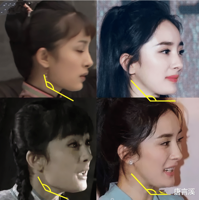 朱芊佩|那些削骨“一刀切”的明星还好吗？有的已垮掉，小方脸成最后赢家