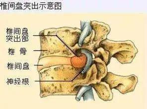 峰哥说表|青皮核桃泡成酒配一中药方