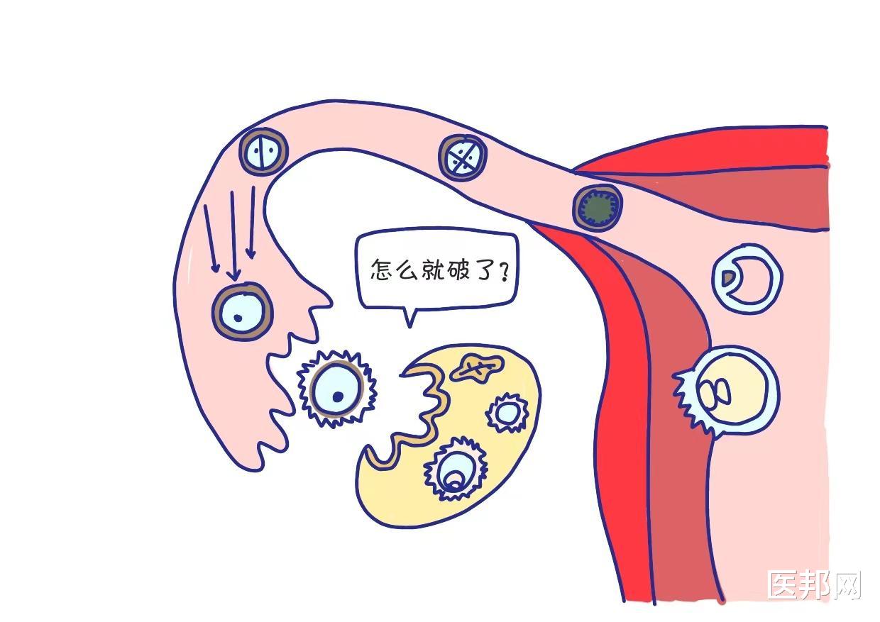 口腔溃疡|外力强烈冲击,可导致女性黄体破裂?还能不能愉快地为爱鼓掌了