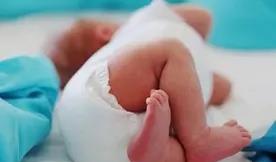 我是妈妈|夏季来临,宝宝红屁屁“成灾”,家长做好日常护理,娃才不会受罪