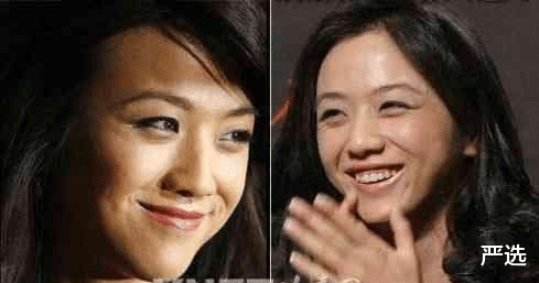 严选|泰国身价3百亿的81岁富婆,整容9年只为“皮肤回春”,如今啥样了