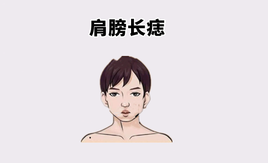 中国易经风水|身上4颗“劳碌”痣，打一辈子工，左手进财右手出，后半生白忙！