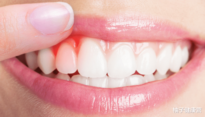 柚子健康营|肝脏不好的人群,要警惕皮肤的4种变化,若发现异样,及时检查