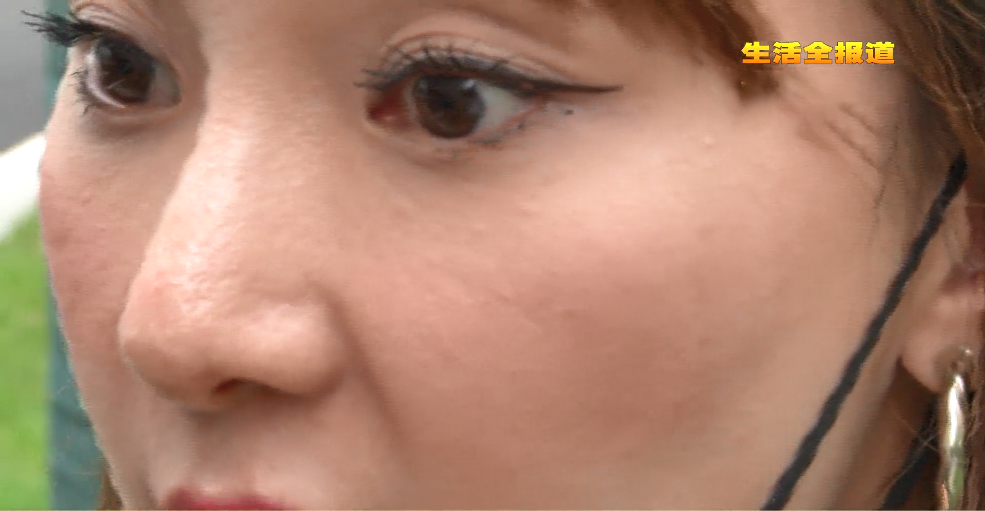 黄鹤观察 爱美,武汉女子医美机构内注射“瘦脸针”,不料三月后,脸瘫了!