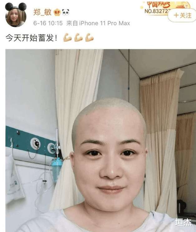 岳云鹏|岳云鹏机场索吻老婆当场被拒，一巴掌打醒岳云鹏