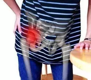 我叫小王|股骨头坏死患者可以看到的自身症状有哪些呢？