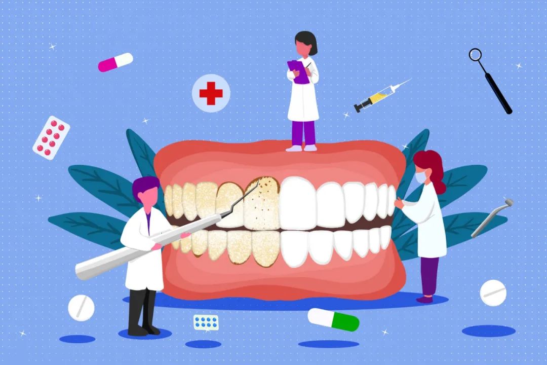 洁牙|马上年底了，到底要不要洗牙？看完这篇文章再做决定吧！