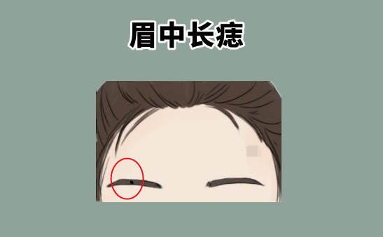 中国易经风水|身上5颗“黄金”痣,天生皇帝命,一个聚财,一个生金,越过越有!