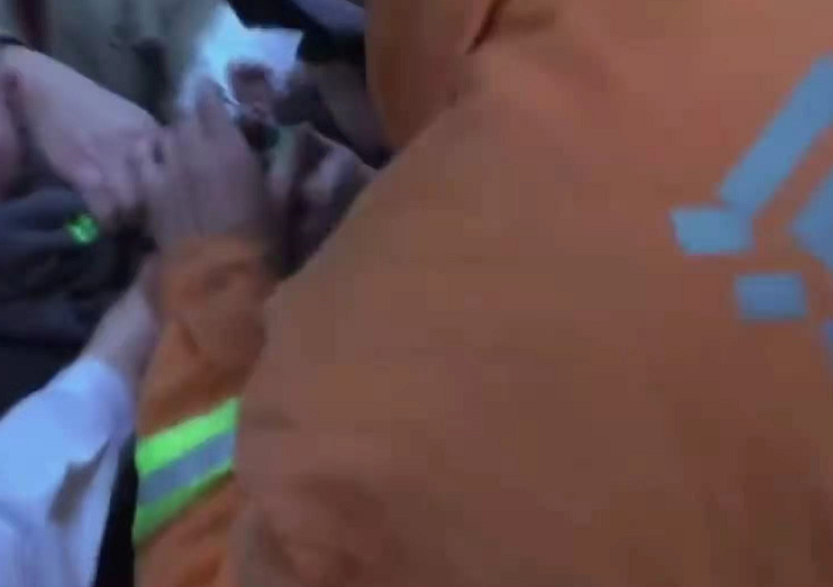 邯郸之窗 幼童手指卡进水果刀邯郸消防紧急救援