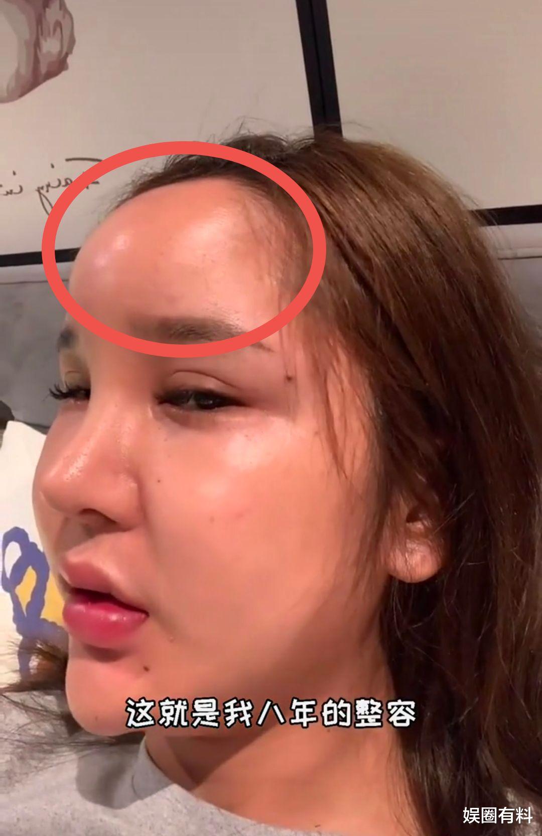 整容|人造美女“桃花宝宝”，8年整容连亲妈都快认不出，她到底图啥？