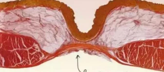 脐带|老人常说肚脐眼的“泥”不能抠,到底什么原因?放大1000倍明白了