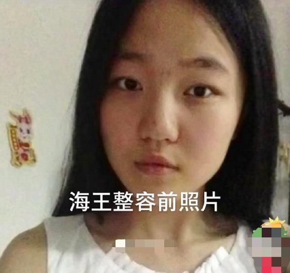 肖战|捞女的一生?项思醒整容照片被扒,千万彩礼不退王思聪都直呼高端